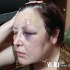 Из-за водителя-лихача жительница Владивостока получила серьезные травмы в автобусе (ФОТО)