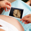 УЗИ по беременности рекомендуется делать на самом современном аппарате *Accuvix A30:* 3D УЗИ плода позволяет получить исчерпывающую информацию о состоянии малыша — newsvl.ru