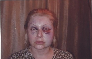 Избитая Маргарита Волкович — newsvl.ru