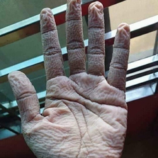 В  «Тысячекоечной» больнице показали, как выглядят руки медиков после смены в «красной зоне» 