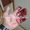 Пострадавший уверяет, что палец ему откусила дворняга — newsvl.ru