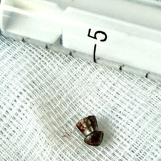 Хирурги во Владивостоке извлекли из лица подростка пулю от воздушки